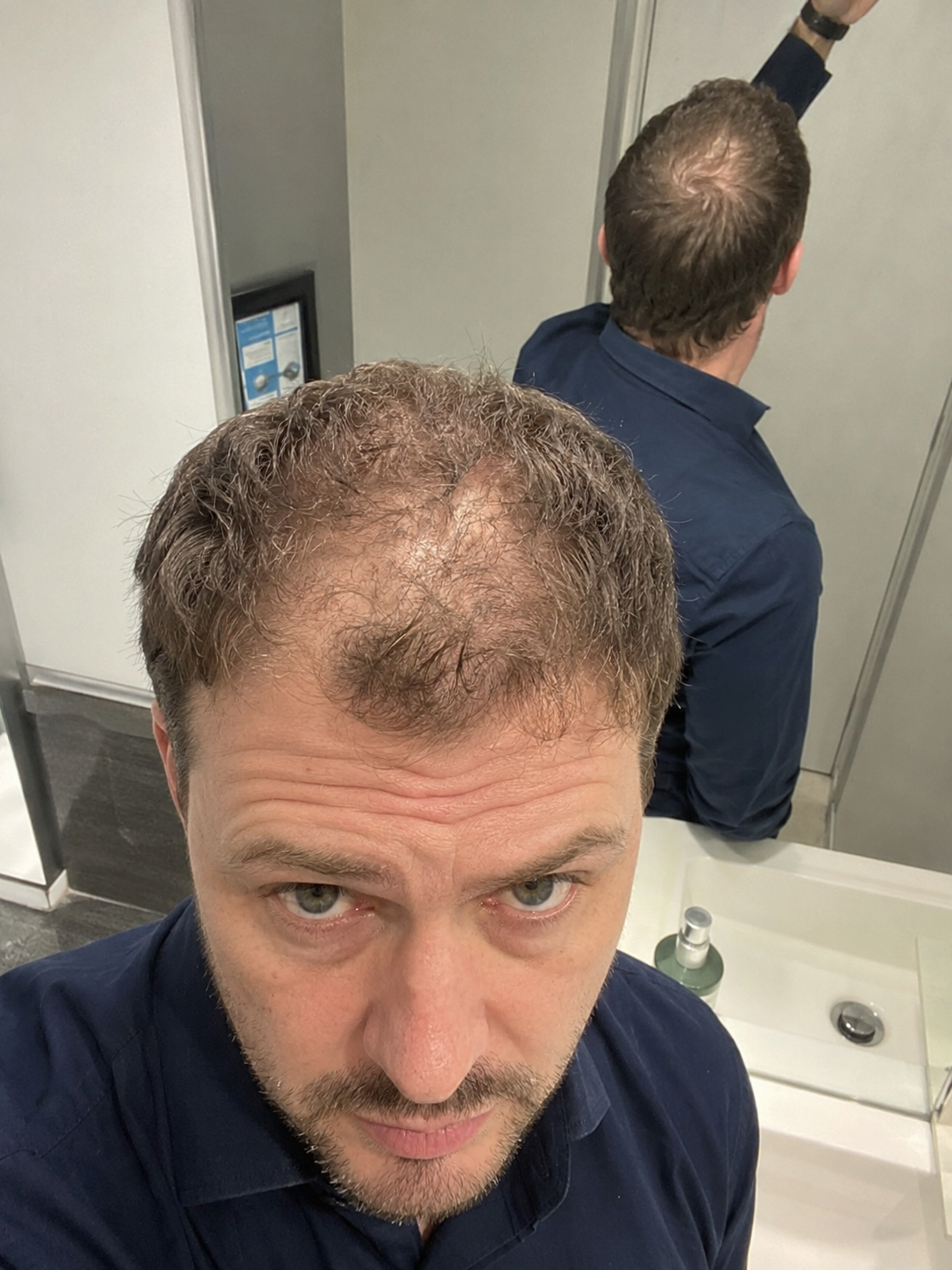 Confident man with fuller-looking hair after using Hair Genetics fibres