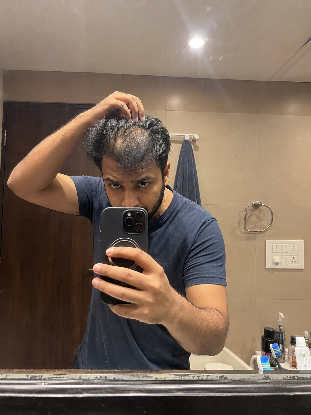 Diffuse thinning on top