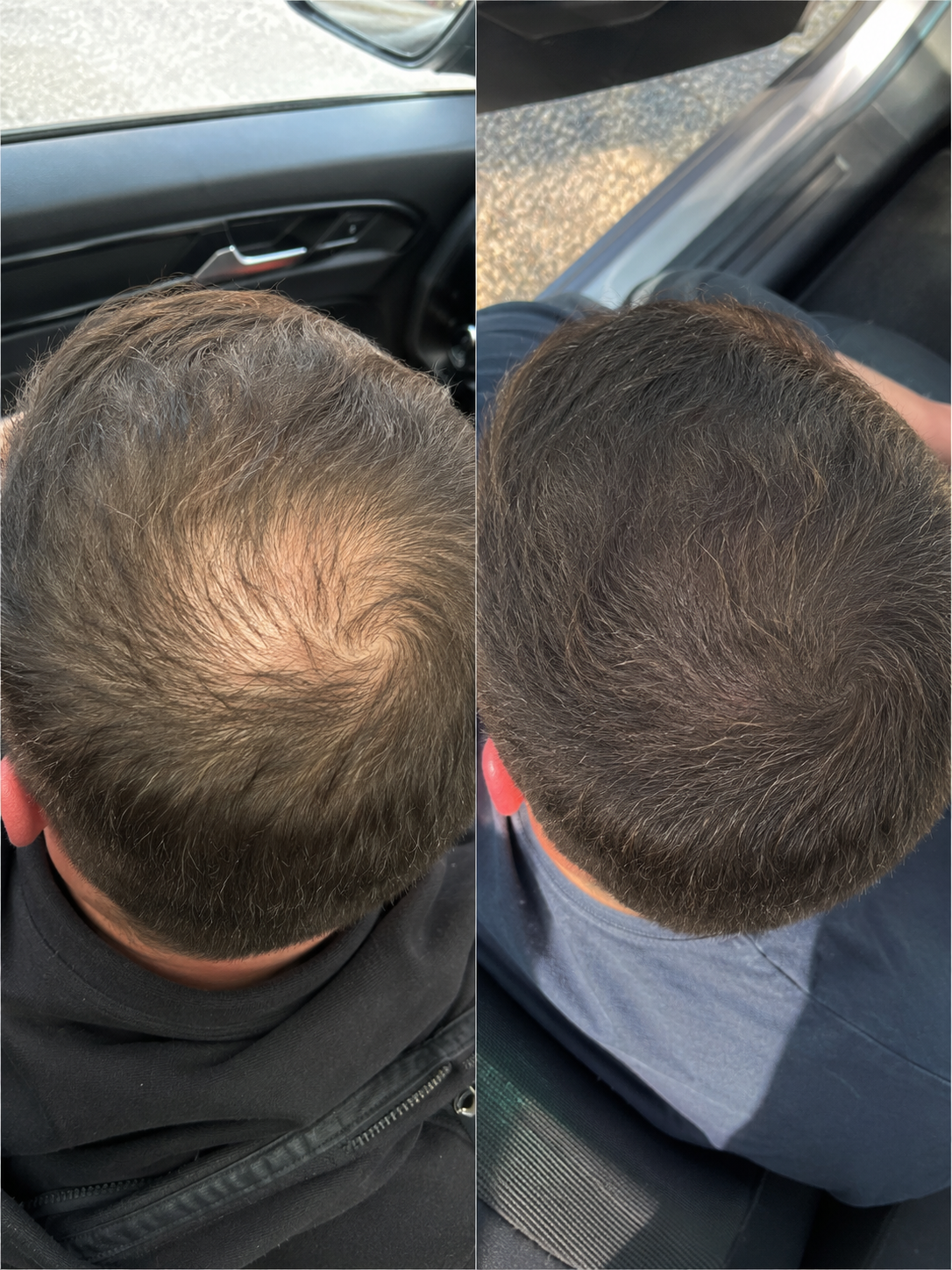 Customer result — Ben H.