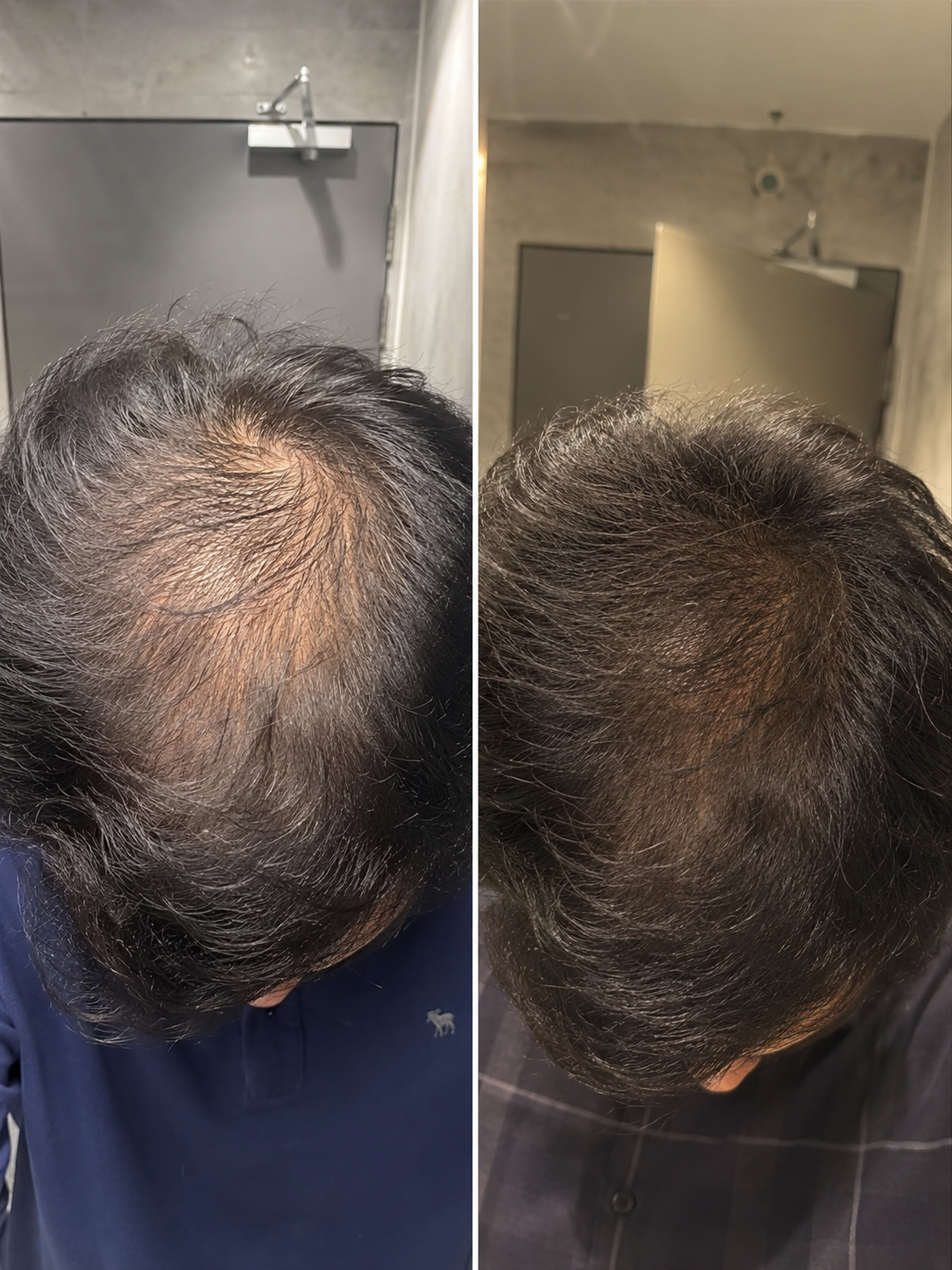 Customer result — Vikram J.