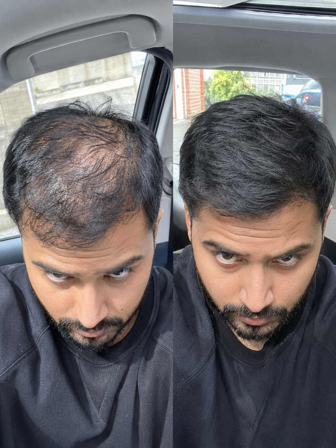 Customer result — Olly W.